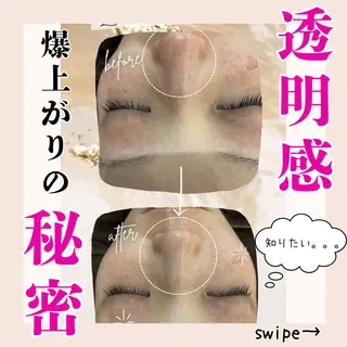 毛穴洗浄専門サロン/CareNa梅田【毛穴/ケアナ】所属・CareNa梅田店 🌿住田摩利弥のエステ・リラクイメージ