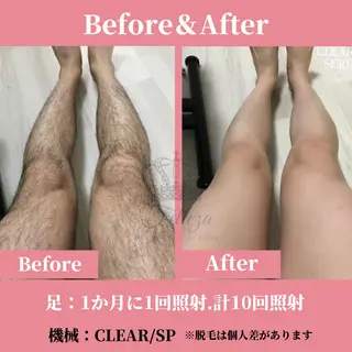 メンズ 有人型セルフサロン 脱毛/痩身/美顔のその他イメージ