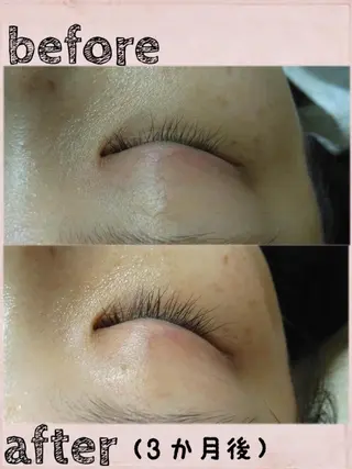 マツエク・マツパ エステサロンvivi 脱毛・エステ・まつ毛のその他イメージ