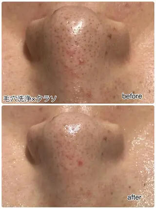 ENCHANT 脱毛.小顔.毛穴のエステ・リラクイメージ