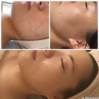 薮 愛のエステ・リラクイメージ