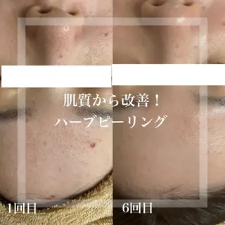 WHITE AQUA 北千住店のエステ・リラクイメージ