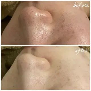 メンズ メナード岐阜茜部 杉浦のエステ・リラクイメージ