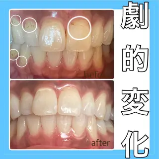 Monreve所属・美人スイッチdiet スーパージェクションのその他イメージ