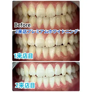 プラチナムビューティー柏所属・【歯科提携】柏ホワイ トニングスタイルのその他イメージ