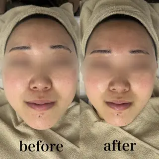 フェイシャルサロン CHIARA 荒田のエステ・リラクイメージ