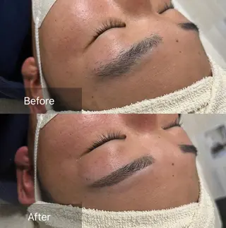 アイブロウ for woman所属・森 美優のエステ・リラクイメージ