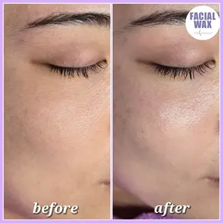 facial salon Lily所属・salon Lilyのエステ・リラクイメージ