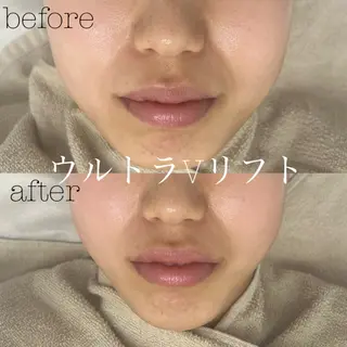 フェイシャルサロン CHIARA 荒田のエステ・リラクイメージ