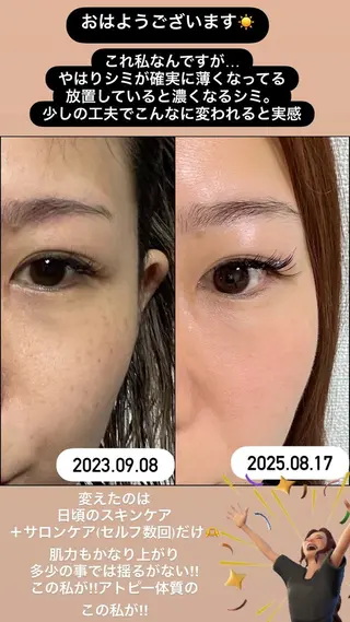 LiZA エステティックサロンのエステ・リラクイメージ