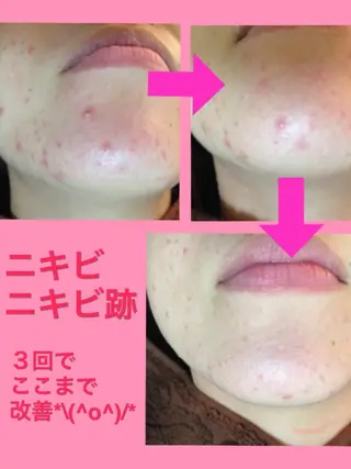 痩身リンパダイエット 隠れ家サロンチャームのエステ・リラクイメージ