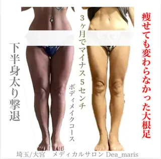 private salon Dea_maris シュガーリング&パーソナルボディケア所属・シミ改善・韓国肌管理 ボディメイク痩身のその他イメージ