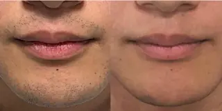 メンズ プライベートサロンBRAG所属・プライベートサロン BRAG🏠男女OKのエステ・リラクイメージ