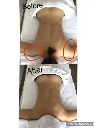 子宮矯正/腸揉み/ シュガーリング脱毛のエステ・リラクイメージ