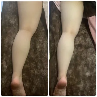 アロマ･美容鍼･カッ ピング「麗」鍼灸院のエステ・リラクイメージ