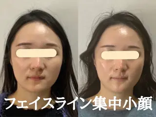 最速小顔・肌質管理 ❣️エスポワールのエステ・リラクイメージ