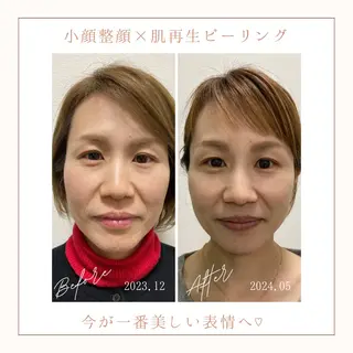 小顔×肌質改善サロン soin〔ソワン〕のエステ・リラクイメージ