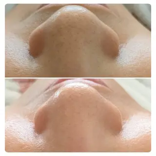 SHINY エステサロンのその他イメージ