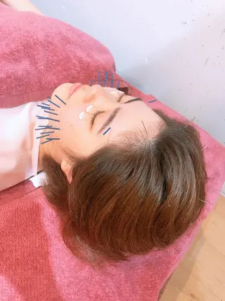 美容鍼灸女性専用 りんご鍼灸治療院のその他イメージ