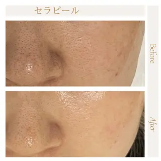 privatesalon icca所属・mana iccaのエステ・リラクイメージ