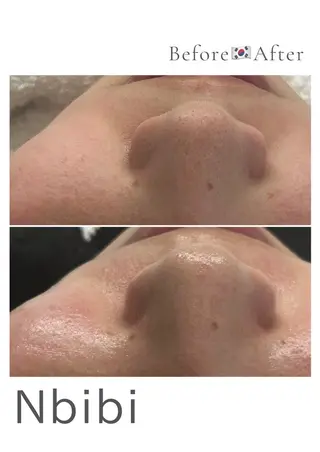 韓国🇰🇷価格 サロン_Nbibiのエステ・リラクイメージ