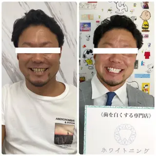 ホワイトニングラウンジ横須賀所属・ホワイトニング Lounge横須賀のその他イメージ