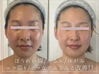 頭蓋骨小顔コルギPerm所属・頭蓋骨小顔コルギ Permのその他イメージ