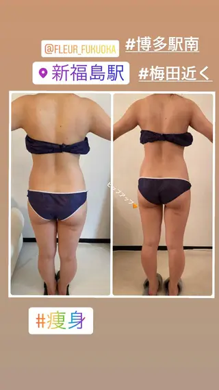 FLEUR大阪・整体 ・ハイフ・痩身・小顔のエステ・リラクイメージ