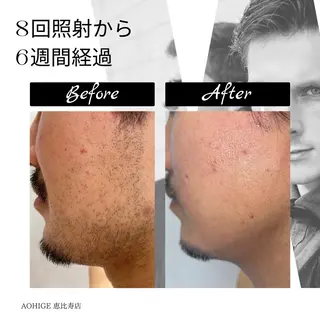 メンズ 【ena】 YUKOのマツエク・マツパデザイン