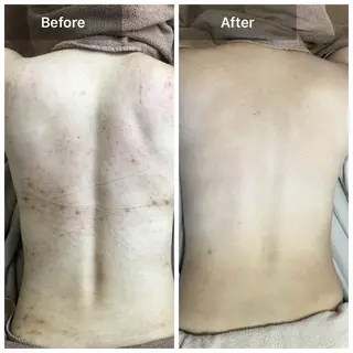 ハーブピーリング 専門店MOKA所属・ハーブピーリング専門 MOKAのエステ・リラクイメージ