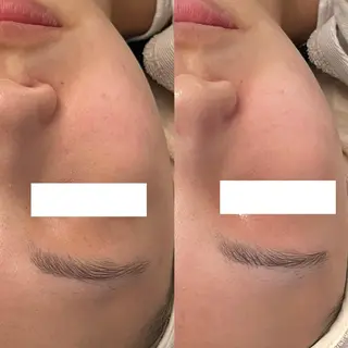 ✨美肌水光✨ アトリエリュバンのエステ・リラクイメージ