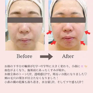 PRETTIEST SHINE所属・山田 浩子のエステ・リラクイメージ