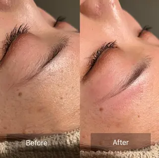 アイブロウ for woman所属・森 美優のエステ・リラクイメージ