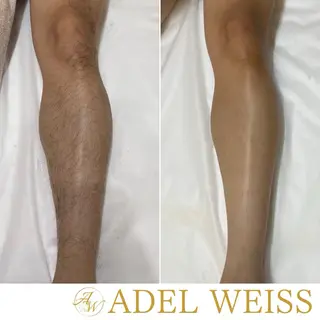 毛穴ケア＆脱毛サロン　ADEL WEISS所属・毛穴ケア＆脱毛サロン ADEL　WEISSのエステ・リラクイメージ