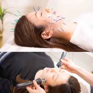 目黒/小顔/骨盤/ 美容鍼/美顔鍼/小林のエステ・リラクイメージ