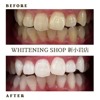 メンズ ホワイトニング ショップ新小岩店のその他イメージ