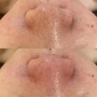 BELCIA福岡店　récolte de BELCIA（レコルトデベルシア）所属・BELCIA福岡店 レコルトデベルシアのエステ・リラクイメージ