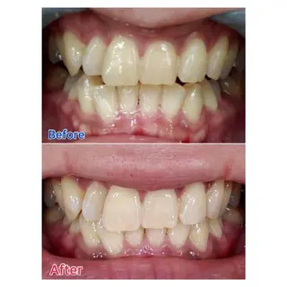 MBEAUTYSALON 千葉店・京成大久保所属・Melty 輝のその他イメージ