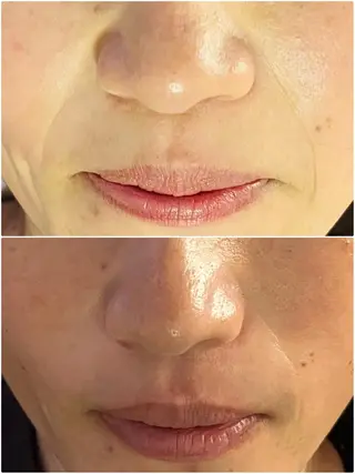 アロマ･美容鍼･カッ ピング「麗」鍼灸院のエステ・リラクイメージ