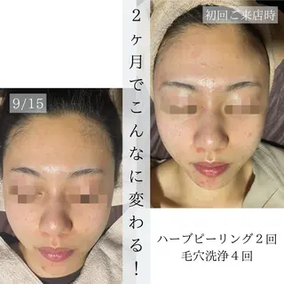 ハーブピーリング・毛穴ケア専門サロンSalon de LENA所属・ハーブピーリング 専門店/名古屋駅前店のエステ・リラクイメージ