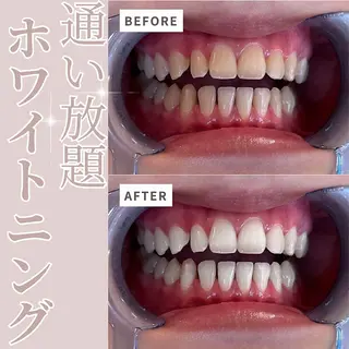 ecxia white 高田馬場所属・セルフホワイトニング エクシア 高田馬場のその他イメージ