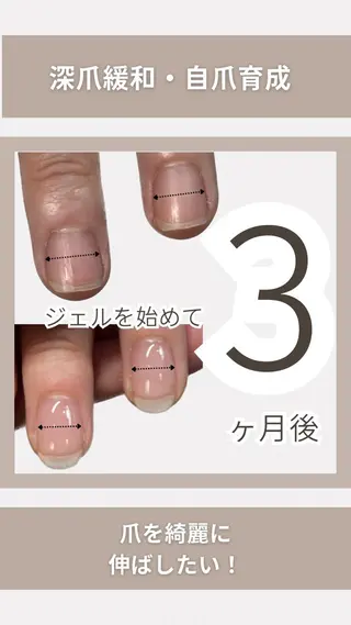 ネイル KIKOA NAIL キコアネイルのネイルデザイン