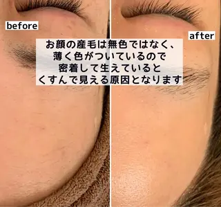 美肌コラーゲン脱毛SINCERITE【サンセリテ】所属・瀬野 のぞみのエステ・リラクイメージ