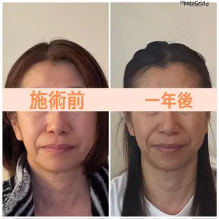 小顔矯正サロン　ReFace Fusae（リフェイスフサエ）所属・小顔矯正サロン リフェイスフサエのエステ・リラクイメージ