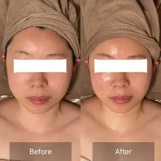 Ｂ&H所属・頭痛•肩こり専門/ 眉サロンB&H心斎橋のエステ・リラクイメージ