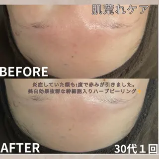 ハーブピーリング専門店YOOTOX所属・大橋 唯のエステ・リラクイメージ