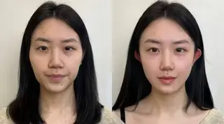 ショート aliaハイフ&水光ジェットサロン所属・aliaハーブ水光店 エステティシャン募集のエステ・リラクイメージ