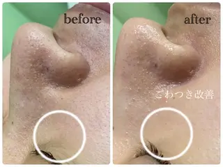 デ・アイム新潟北所属・サイトウ .のエステ・リラクイメージ