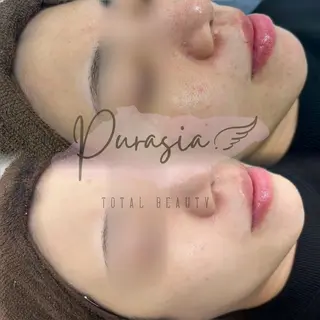 🪞Purasia. 🫧韓国肌管理💎のエステ・リラクイメージ