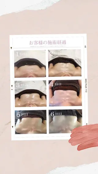 Monreve所属・美人スイッチdiet スーパージェクションのその他イメージ